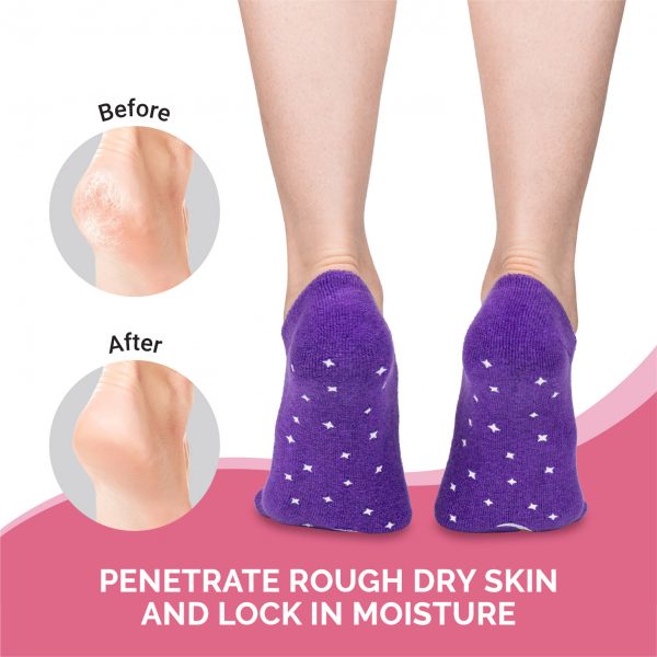 Moisturizing Socks Moisturizing Gloves Gel Gloves and Gel Socks for Dry  Cracked Heels & Hands Spa Treatment, Gel Lining Infused with Essential Oils  and Vitamins (Fuzzy Pink) 